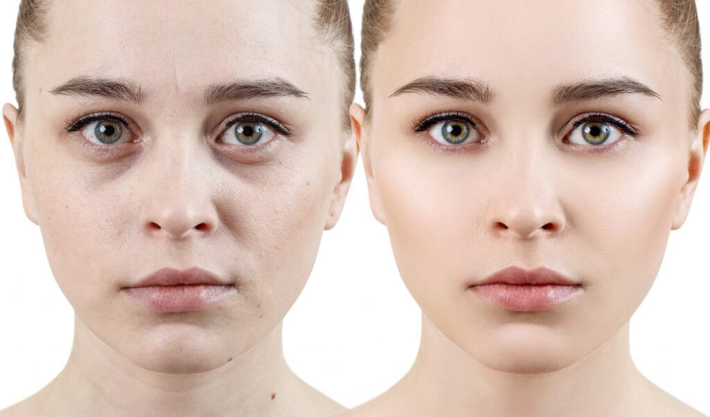 Piel antes y después Dermawand